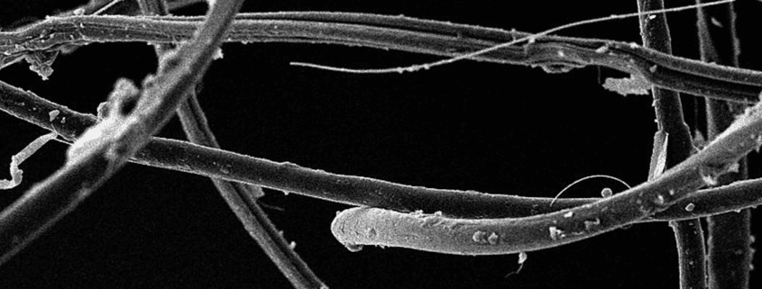 Mikroskopisches Bild von Mikroplastikfasern